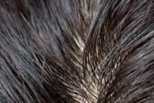Why Does My Hair Get Greasy So Fast? Causes and Fixes